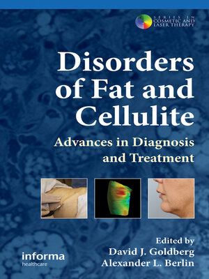 cover image of Disorders of Fat and Cellulite